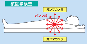 体から出てくる放射線をとらえる検査