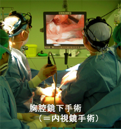 胸腔鏡下手術（内視鏡手術）