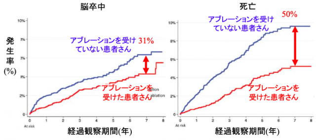 アブレーションは脳梗塞を31%、死亡を50%抑制する