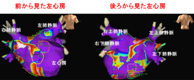 CFAEマッピング、カフェマッピング